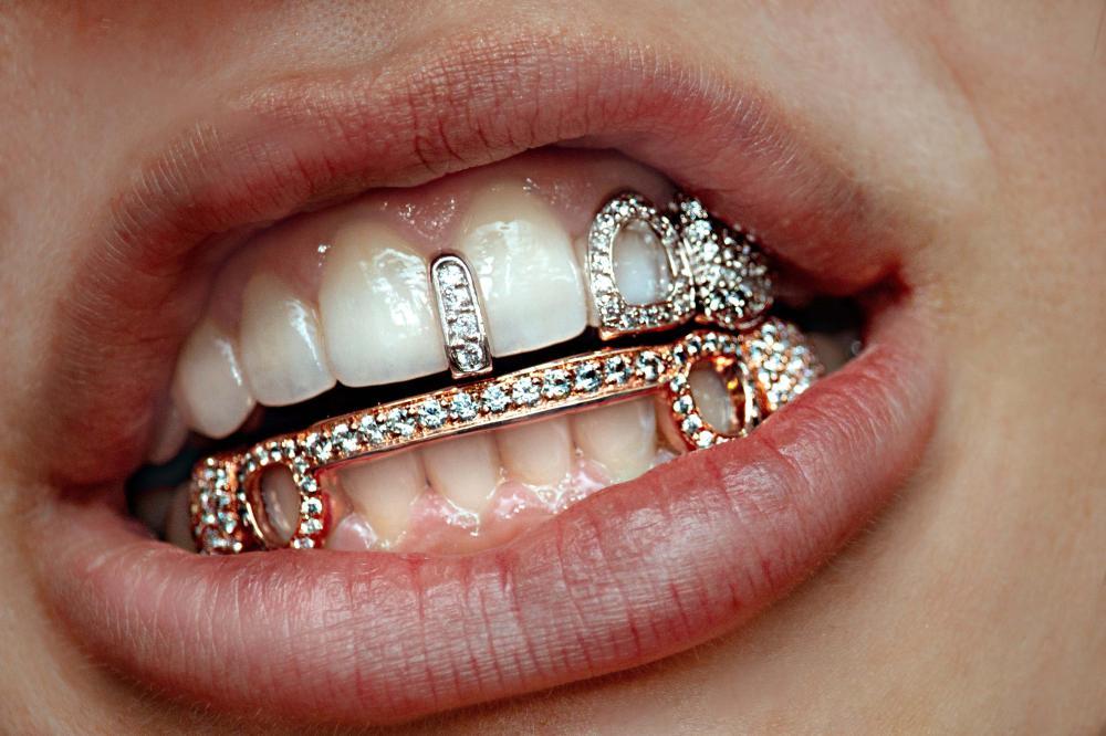 Bijoux dentaires (2)