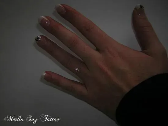 microdermal (2)