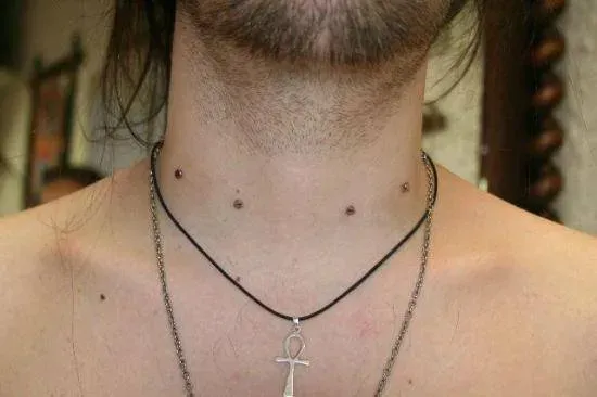 microdermal (4)