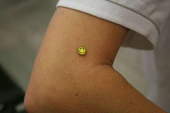 microdermal (5)