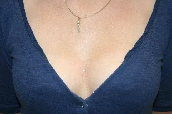 microdermal (10)