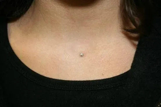 microdermal (11)