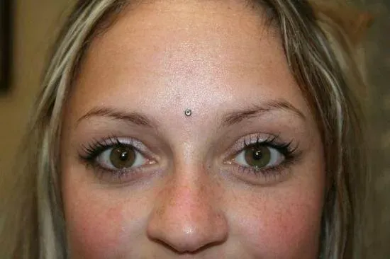 microdermal (13)