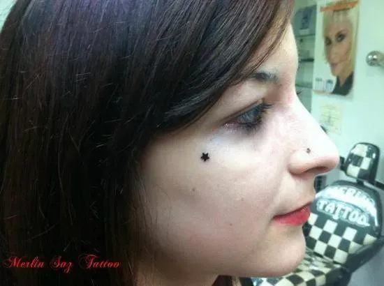 microdermal (14)