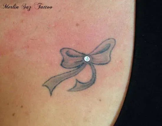 microdermal (16)