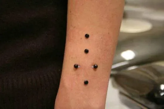 microdermal (17)