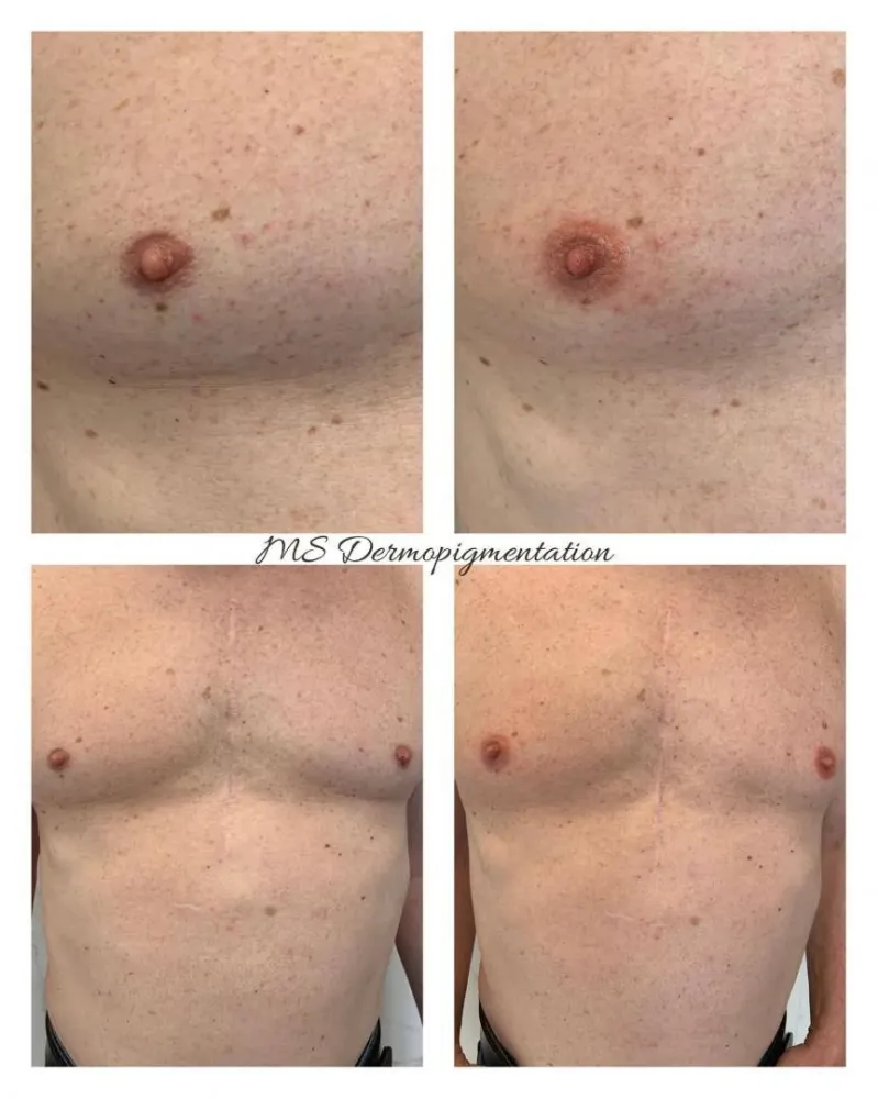 dermopigmentation (2)