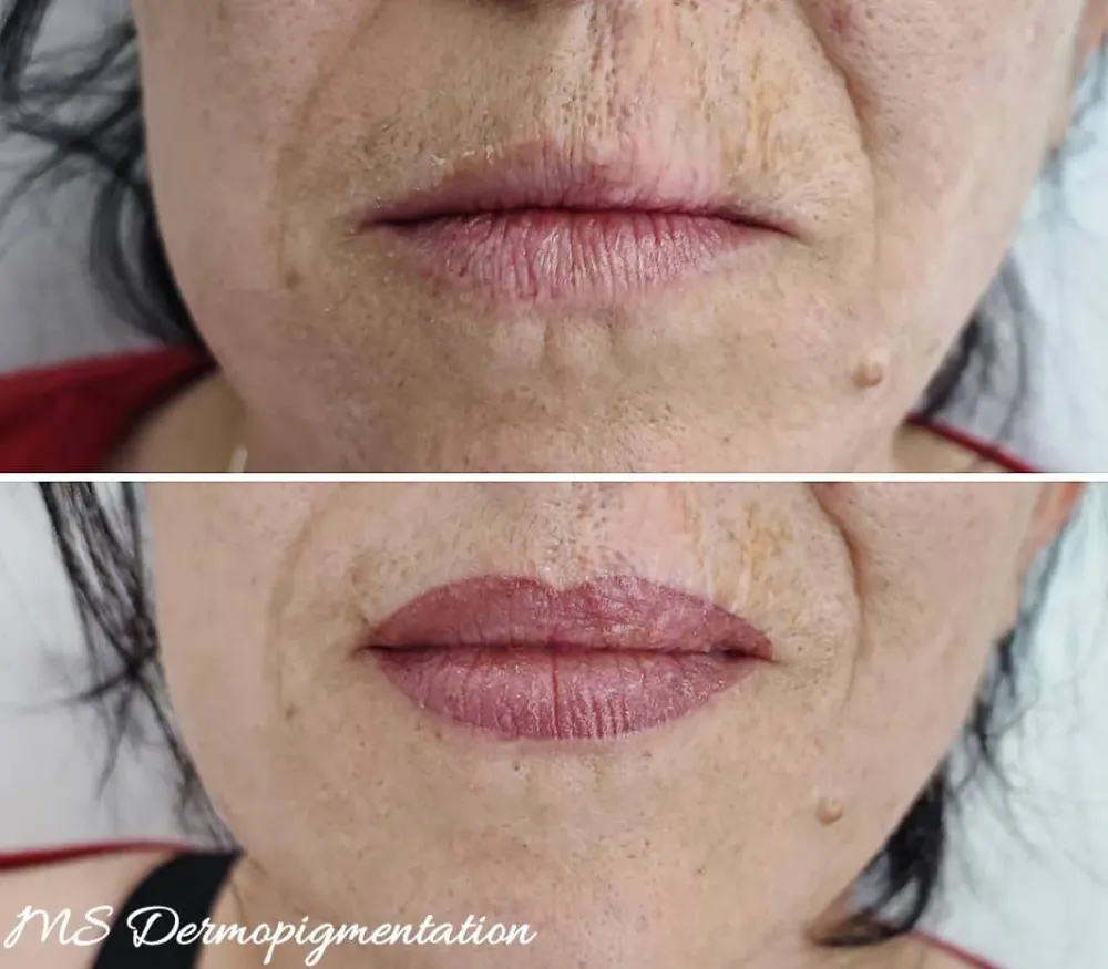 dermopigmentation (4)