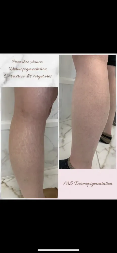 dermopigmentation (1)
