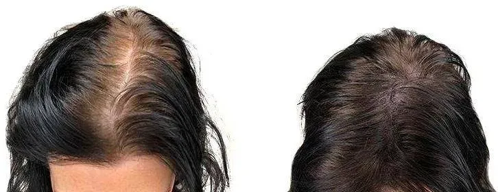 dermopigmentation (7)