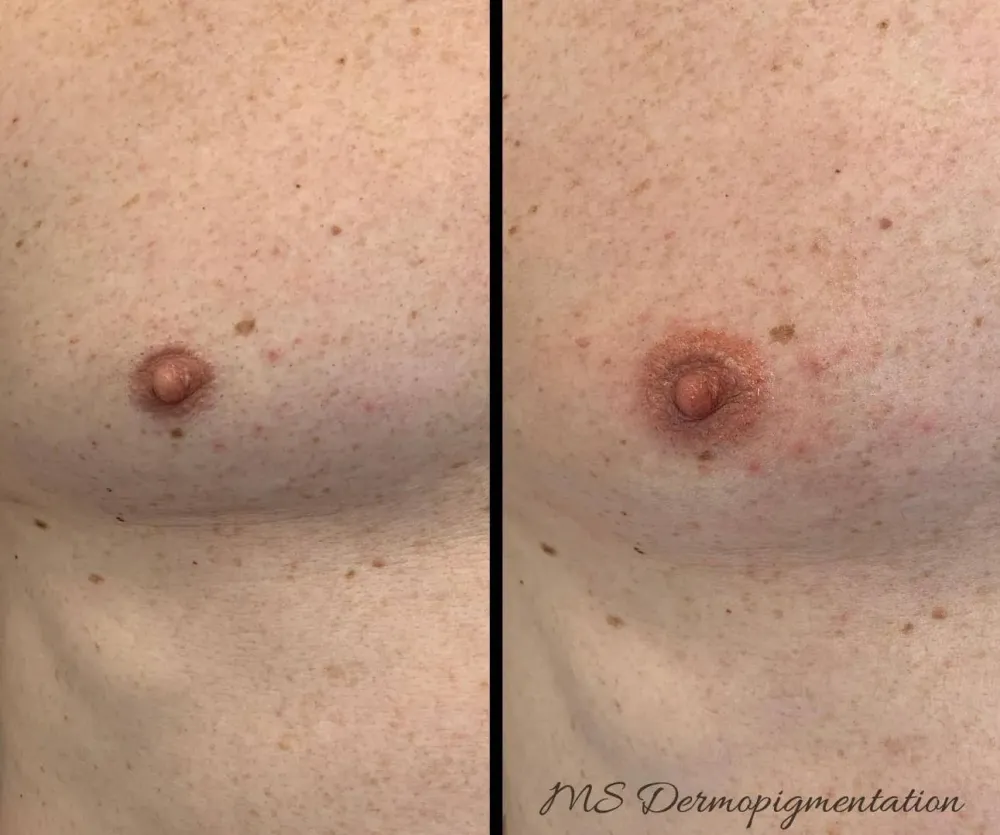 dermopigmentation (8)