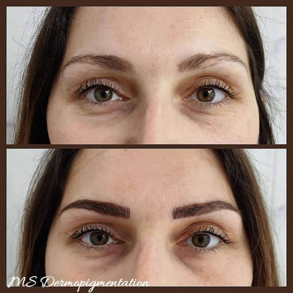 Dermopigmentation près de Langres